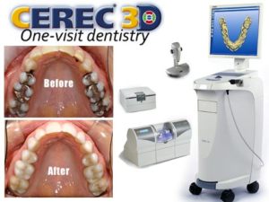 CEREC Dentist Wildomar, CA